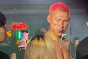 八角笼之战！街球皇帝威姆斯还是猛 恶鼠鼻子都被打歪了